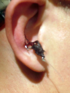 hamecon dans oreille